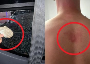 Vándalos atacaron bus de Millonarios y dejó jugador agredido