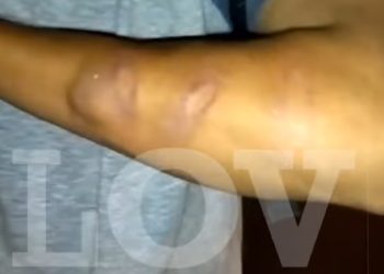 ¡Denuncian!; Abuso policial a las afueras de la UT