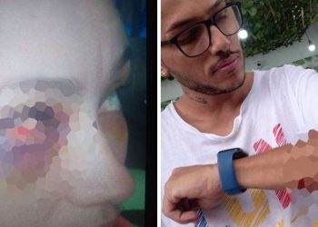 Cambió de rumbo la historia del machetazo pasional en Ibagué