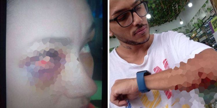 Cambió de rumbo la historia del machetazo pasional en Ibagué