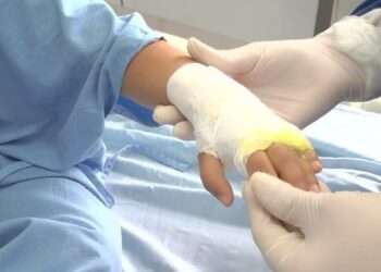 Preocupante aumento de quemados por pólvora en Ibagué durante las festividades