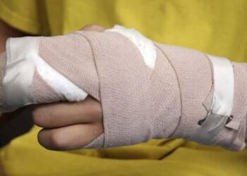 Tres personas quemadas por pólvora durante la Noche de Velitas en Ibagué