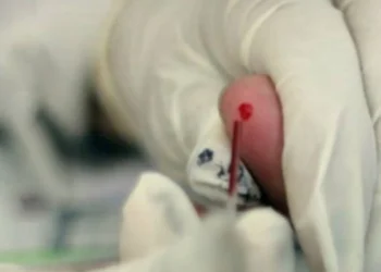 Desmienten alarma sobre “pandemia de VIH” en Colombia: cifras muestran estabilidad y mejor diagnóstico