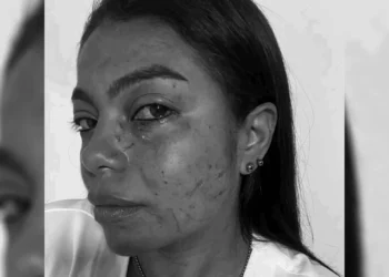 Madre agrede a enfermera por llanto de su hijo en hospital de Ciudad Bolívar