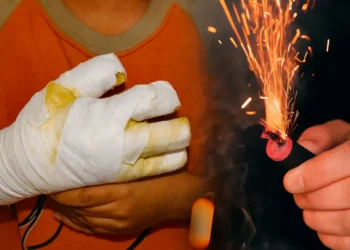 Tolima suma 13 personas quemadas con pólvora