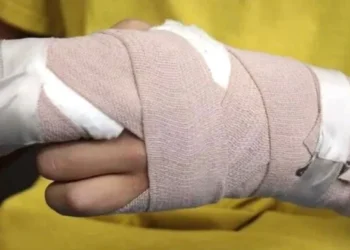 Dos heridos por pólvora en Ibagué durante la ‘Noche de Velitas’