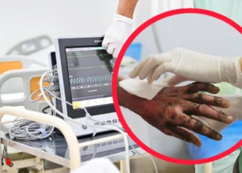 Alerta amarilla en Ibagué por riesgo de quemaduras y lesiones por pólvora